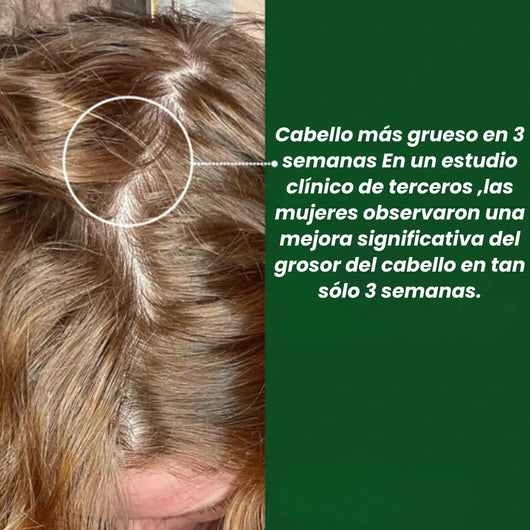 WILLO Cápsulas para el crecimiento del cabello - OFERTA 2x1