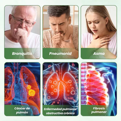 Timilk® LungPure - Inhalador desintoxicante a base de hierbas