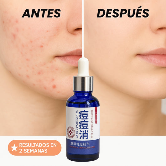 Serum Koreano Anti Acne Tu piel clara, sin drama.