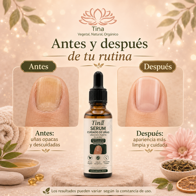 NailClear™ – Sérum de Cuidado para Uñas y Pies