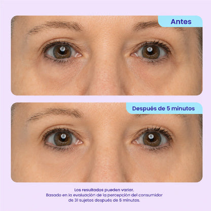 Gopure™ - Contorno de ojos ✨ - OFERTA 2x1