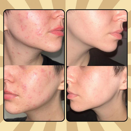 FacialTallow - Crema Facial de Sebo y Miel